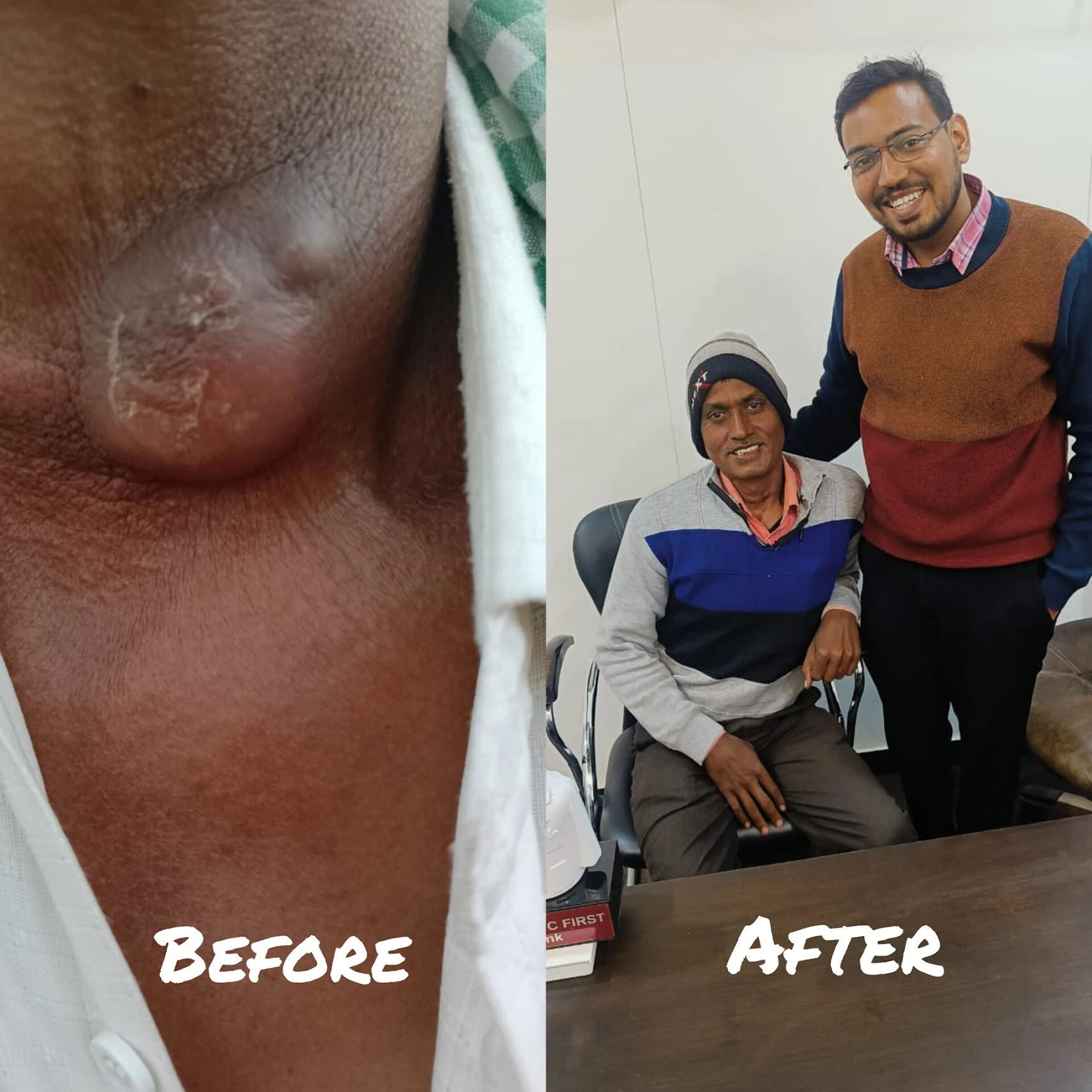 before after cancer treatment