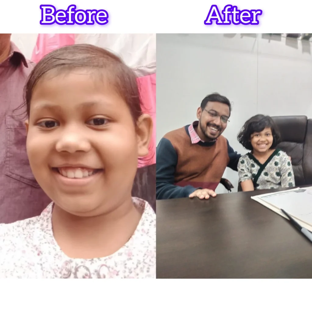 before after cancer